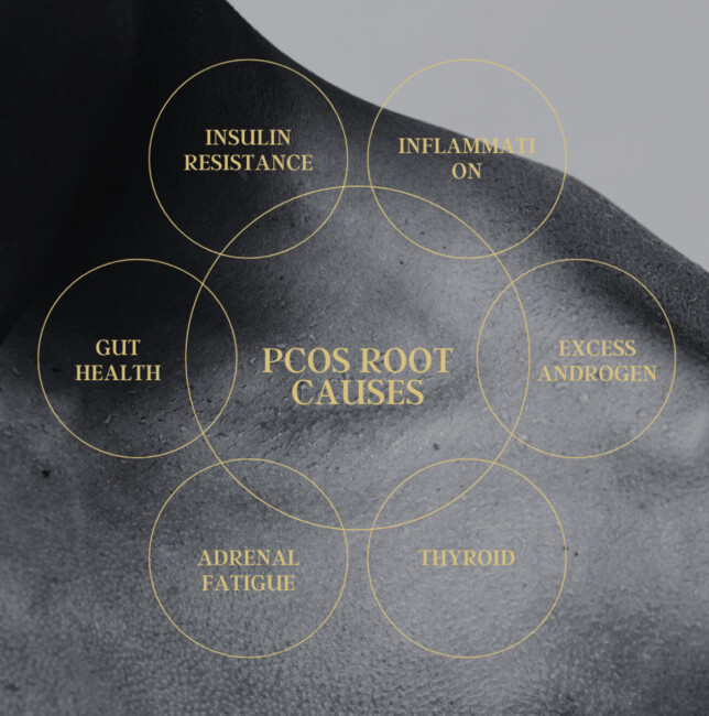 Aditi Guha PCOS Root Causes